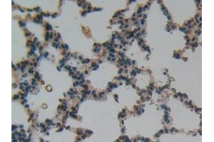 IHC-P analysis of Rat Lung Tissue, with DAB staining. (LIFR anticorps  (AA 642-791))