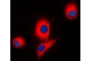 Immunofluorescent analysis of ICK staining in HEK293T cells. (ICK anticorps)