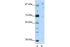 WB Suggested Anti-GLIS3 Antibody Titration:  2. (GLIS3 anticorps  (N-Term))