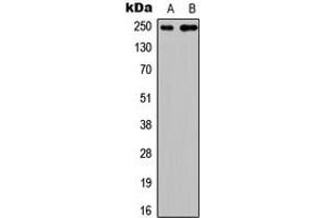 Western blot analysis of CABIN1 expression in HEK293T (A), PC12 (B) whole cell lysates.
