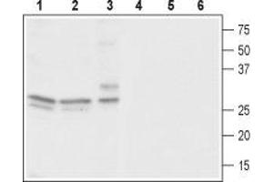 Western blot analysis of rat brain (lanes 1 and 4), mouse brain (lanes 2 and 5) and human neuroblastoma (SH-SY5Y) cells (lanes 3 and 6): - 1-3. (CACNG3 anticorps  (C-Term, Intracellular))