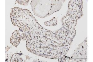 Immunoperoxidase of monoclonal antibody to ATF1 on formalin-fixed paraffin-embedded human placenta.