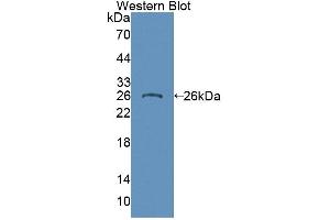 Western blot analysis of the recombinant protein. (NG2 anticorps  (AA 559-776))
