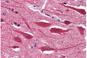 Human Brain, Cortex (formalin-fixed, paraffin-embedded) stained with STX2 antibody ABIN351556 at 5 ug/ml followed by biotinylated goat anti-rabbit IgG secondary antibody ABIN481713, alkaline phosphatase-streptavidin and chromogen. (STX2 anticorps  (AA 1-19))