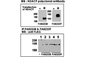Both anti-HDAC9 N-term  and C-term  polyclonal antibody were tested by WB and IP-WB using HeLa and HeLa-HDAC9 transfected cells. (HDAC9 anticorps  (C-Term))