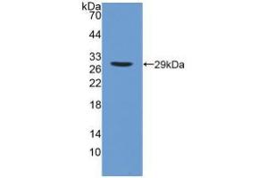 Western blot analysis of recombinant Human iPLA2. (PNPLA2 anticorps  (AA 484-701))
