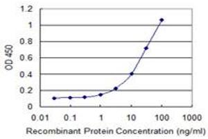 anti-Cat Eye Syndrome Chromosome Region, Candidate 1 (CECR1) (AA 402-511) antibody