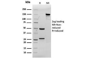 SDS-PAGE Analysis Purified CDX2 Mouse Monoclonal Antibody (rCDX2/1690). (Recombinant CDX2 anticorps  (AA 150-249))