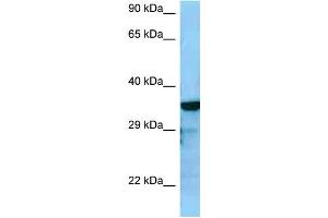 WB Suggested Anti-RGS4 Antibody Titration: 1. (RGS4 anticorps  (C-Term))