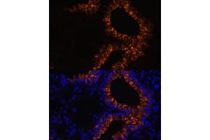 Immunofluorescence analysis of mouse lung cells using SCGB1 antibody (6997) at dilution of 1:100.