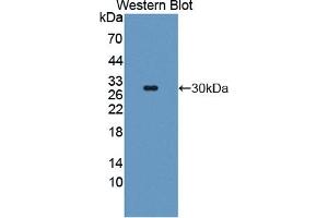 Detection of Recombinant TMPRSS2, Mouse using Polyclonal Antibody to Transmembrane Protease, Serine 2 (TMPRSS2) (TMPRSS2 anticorps  (AA 254-490))
