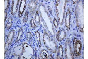 Image no. 2 for anti-Keratin 5 (KRT5) (AA 1-273) antibody (ABIN1490696)