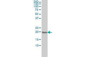 MPHOSPH6 monoclonal antibody (M01), clone 1D8-2A8 Western Blot analysis of MPHOSPH6 expression in HeLa . (MPHOSPH6 anticorps  (AA 1-160))