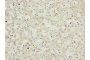 Immunohistochemistry of paraffin-embedded human liver tissue using ABIN7162962 at dilution of 1:100