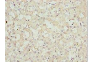 Immunohistochemistry of paraffin-embedded human liver tissue using ABIN7162962 at dilution of 1:100 (PEX3 anticorps  (AA 144-373))