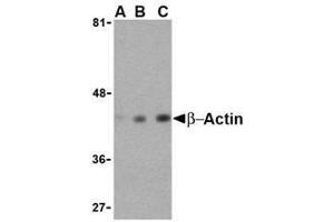 Western blot analysis of beta-actin in HeLa cell lysate with AP30136PU-N beta-actin antibody at (A) 0. (beta Actin anticorps  (C-Term))