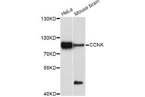 Western blot analysis of extracts of various cell lines, using CCNK Antibody (ABIN5997384) at 1/1000 dilution. (Cyclin K anticorps)