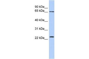 WB Suggested Anti-ZNF428 Antibody Titration: 0. (ZNF428 anticorps  (N-Term))