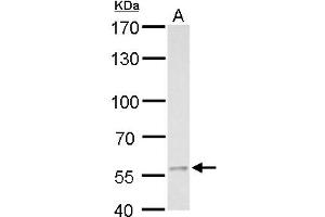 WB Image MCD antibody detects MCD protein by western blot analysis.