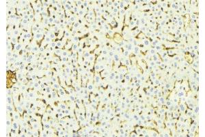ABIN6268680 at 1/100 staining Mouse liver tissue by IHC-P. (alpha Fetoprotein anticorps  (C-Term))