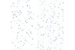 Immunocytochemistry (ICC) image for anti-Replication Protein A2, 32kDa (RPA2) (pSer4), (pSer8) antibody (ABIN7453379) (Recombinant RPA2 anticorps  (pSer4, pSer8))