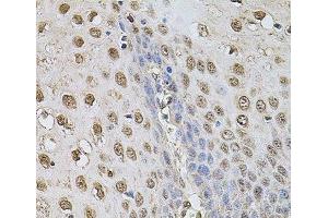 Immunohistochemistry of paraffin-embedded Human esophagus using Cyclin A2 Polyclonal Antibody at dilution of 1:100 (40x lens). (Cyclin A anticorps)