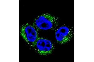 Confocal immunofluorescent analysis of M1 Antibody (Center) 2036c with  cell followed by Alexa Fluor 488-conjugated goat anti-rabbit lgG (green). (AP1M1 anticorps  (AA 199-227))