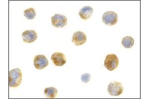 AP20057PU-N Beclin-1 antibody staining of A431 cells by Immunocytochemistry at 1 μg/ml.