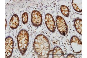 Immunoperoxidase of monoclonal antibody to DARS on formalin-fixed paraffin-embedded human colon.