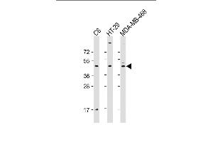 All lanes : Anti-GSK3BAntibody at 1:2000 dilution Lane 1: C6 whole cell lysate Lane 2: HT-29 whole cell lysate Lane 3: MDA-MB-468 whole cell lysate Lysates/proteins at 20 μg per lane. (GSK3 beta anticorps  (AA 2-33))