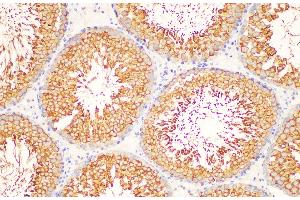 Immunohistochemistry of paraffin-embedded Rat testis using LDHC Polycloanl Antibody at dilution of 1:200