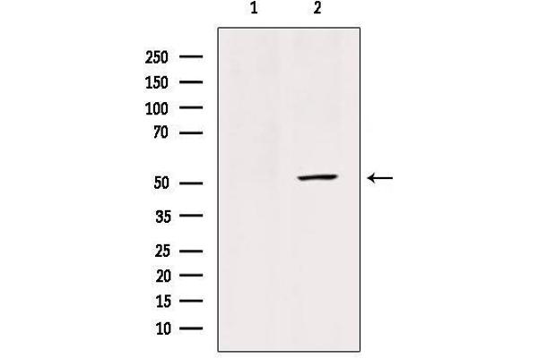 SLC2A3 anticorps  (C-Term)