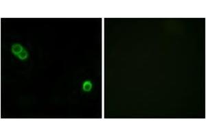 Immunofluorescence analysis of MCF7 cells, using PHCA Antibody. (ACER3 anticorps  (AA 171-220))