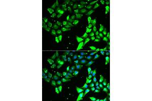 Immunofluorescence analysis of A549 cell using KIF2B antibody. (KIF2B anticorps)