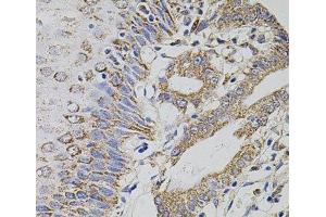 Immunohistochemistry of paraffin-embedded Human esophagus using TRMT2A Polyclonal Antibody at dilution of 1:100 (40x lens).