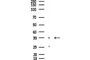 anti-Melanoma Antigen Family B, 2 (MAGEB2) (C-Term) antibody