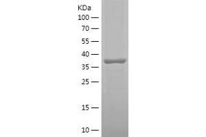 Western Blotting (WB) image for STT3, Subunit of The Oligosaccharyltransferase Complex, Homolog A (STT3A) (AA 475-634) protein (His-IF2DI Tag) (ABIN7125221)