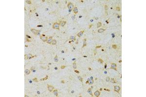 Immunohistochemistry of paraffin-embedded rat brain using SRP19 antibody (ABIN2560139) at dilution of 1:100 (40x lens). (SRP19 anticorps)