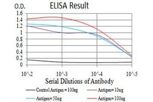 Black line: Control Antigen (100 ng),Purple line: Antigen (10 ng), Blue line: Antigen (50 ng), Red line:Antigen (100 ng)