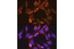 Immunofluorescence analysis of NIH-3T3 cells using  Rabbit mAb (ABIN7265412) at dilution of 1:100 (40x lens).