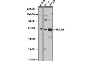 Western blot analysis of extracts of various cell lines, using TRIM38 antibody (ABIN1683145, ABIN3016312, ABIN3016313 and ABIN6219714) at 1:1000 dilution.