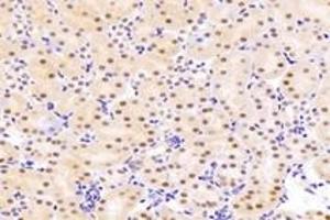 Immunohistochemistry analysis of paraffin-embedded rat kidney using,UCKL1 (ABIN7076157) at dilution of 1: 4000 (UCKL1 anticorps)