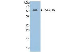 Detection of Recombinant SPON2, Human using Polyclonal Antibody to Spondin 2 (SPON2) (SPON2 anticorps  (AA 119-331))