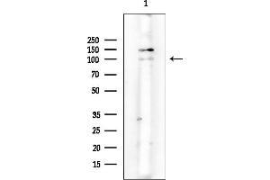 Western blot analysis of lysates from HepG2 cells(LPS 4h treatment), using PFKM Mouse Monoclonal Antibody at 1/1000 dilution.
