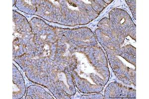 IHC analysis of MRPS22 using anti-MRPS22 antibody (ABIN7600613). (MRPS22 anticorps  (AA 21-329))
