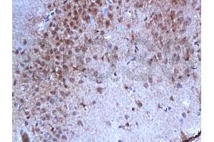 Formalin-fixed and paraffin embedded rat brain tissue with labeled Anti-Phospho-Estrogen Receptor alpha (Ser167) Polyclonal Antibody, Unconjugated (ABIN729493) at 1:200, followed by conjugation to the secondary antibody and DAB staining (Estrogen Receptor alpha anticorps  (pSer167))