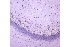 IHC testing of FFPE rat brain tissue with WWOX antibody at 1ug/ml. (WWOX anticorps)