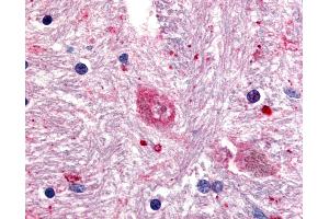 Anti-GPR88 antibody IHC of human brain, caudate. (GPR88 anticorps  (Cytoplasmic Domain))