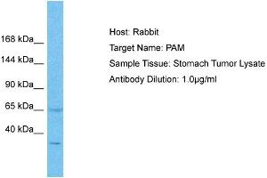 Host: Rabbit Target Name: PAM Sample Type: Stomach Tumor lysates Antibody Dilution: 1. (PAM anticorps  (C-Term))