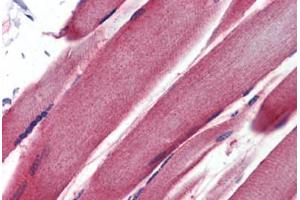 anti-Glutathione S-Transferase mu 2 (Muscle) (GSTM2) (AA 71-120) antibody